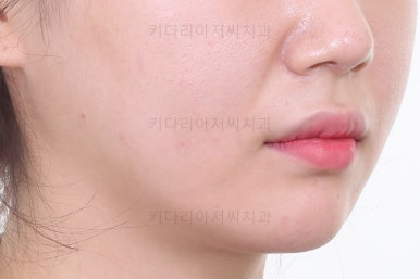 연산동교정치과