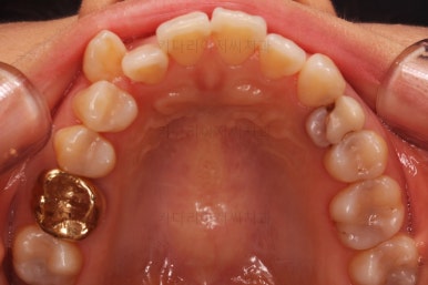 부산인비절라인