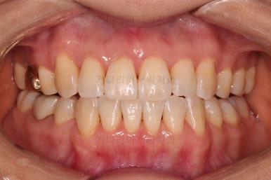 부산인비절라인