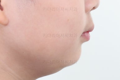 부산어린이교정