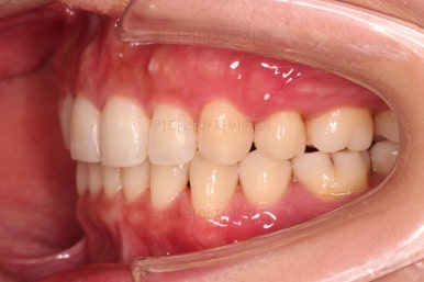 부산인비절라인