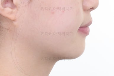 동래구치아교정