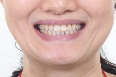 부산치아교정잘하는곳