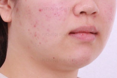 부산치아교정치과