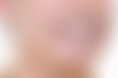 부산앞니교정