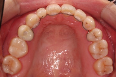 부산인비절라인