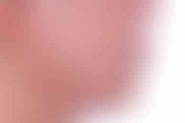 동래임플란트교정