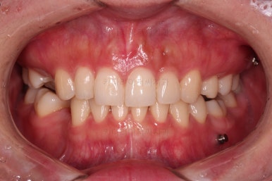 부산인비절라인