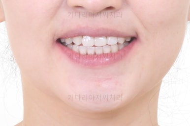 연산동교정치과