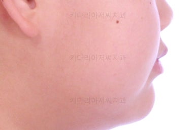 부산교정치과추천