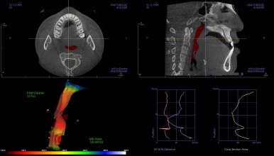 부산긴얼굴긴턱교정