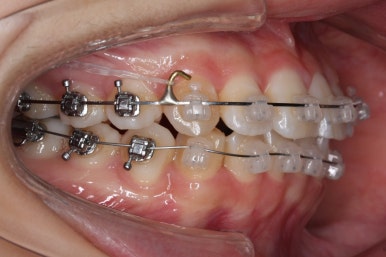 연산동교정치과