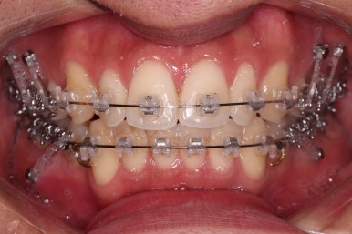 부산연제구교정