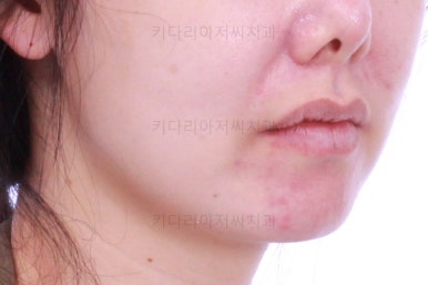 부산재교정치과