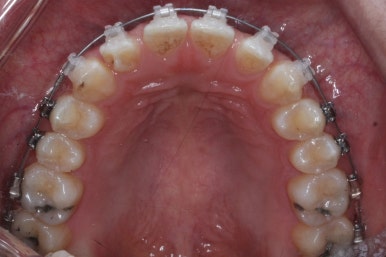 부산치아교정치과