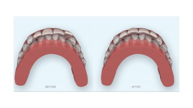 연산동부분교정