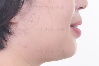 부산교정치과