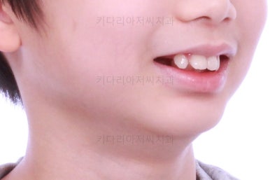 부산어린이교정