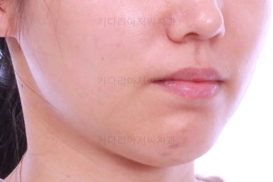부산치아교정잘하는곳