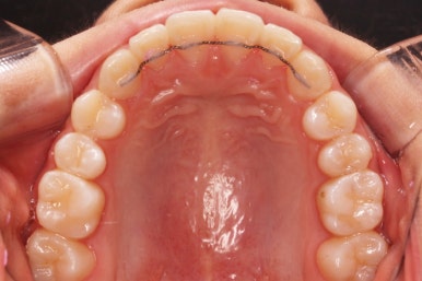 부산치아교정잘하는곳