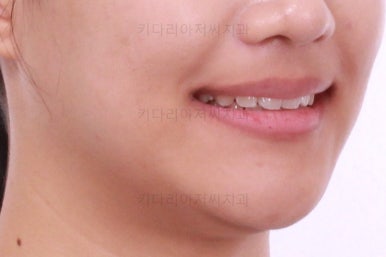 연산동치아교정치과