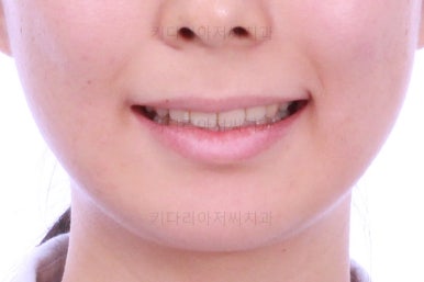 부산무턱교정치과