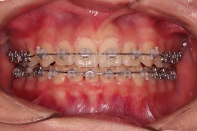 부산교정전문의