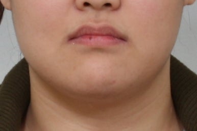 부산치아교정치과