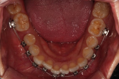 연산동교정치과