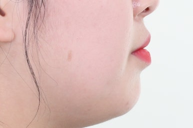 부산치아교정치과