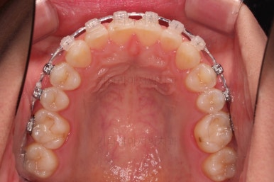 부산교정치과추천