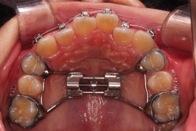 부산청소년교정