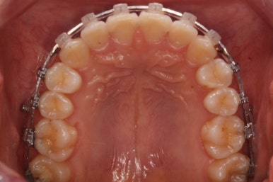 연산동교정치과