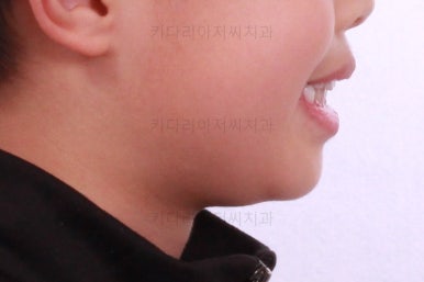 부산어린이교정