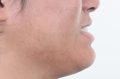 연산동교정