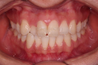 부산교정잘하는치과