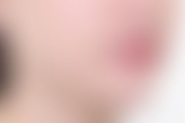 부산개방교합