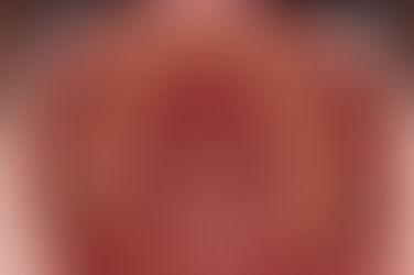 부산덧니교정