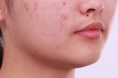 부산치아교정치과