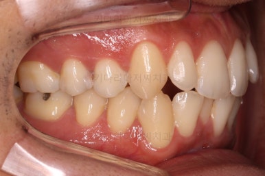 부산연제구교정