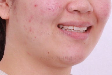 부산치아교정치과