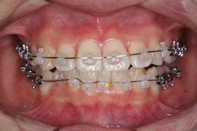 연산동교정치과