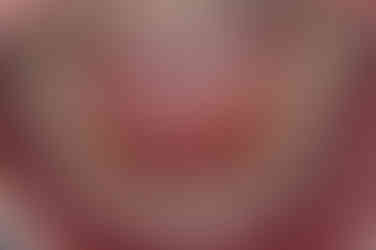 부산주걱턱교정