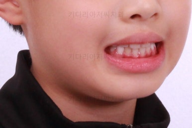 부산어린이교정