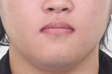 연산동교정
