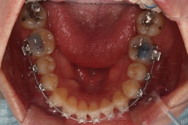 부산치아교정잘하는곳