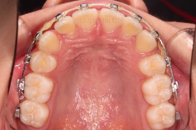 부산치아교정치과