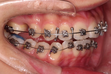 부산치아교정치과