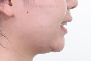 부산교정치료