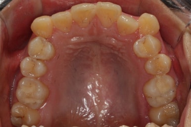 부산교정전문의